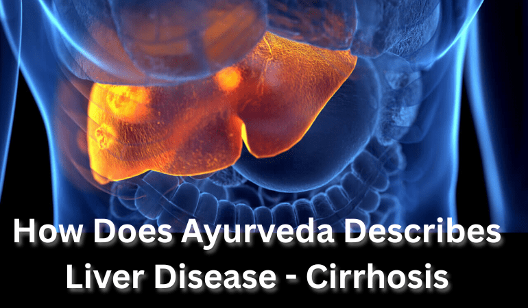 Ayurvedic Cirrhosis Medicine In Delhi